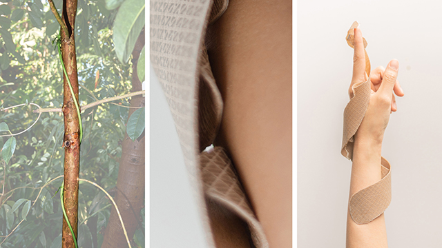 Bioinspired self-tightening splint